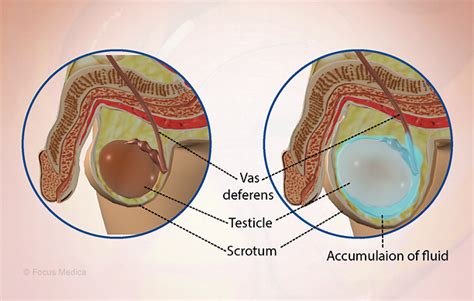 Health Condition : Symptoms, Causes, Treatment and More