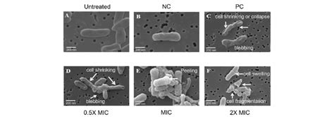 Observation of P. acnes DMST 14916 cell morphology using a scanning ...