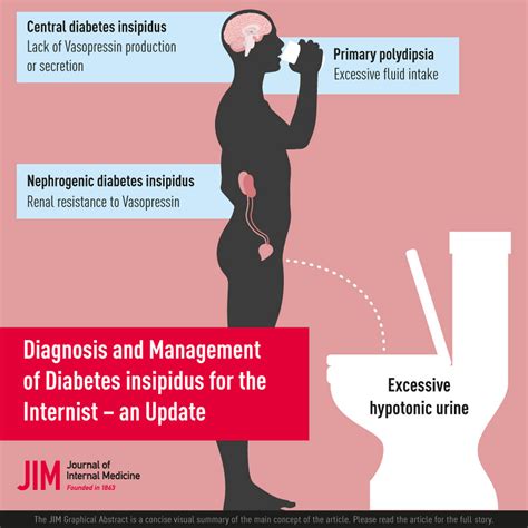 Diagnosis and management of diabetes insipidus for the internist: an ...