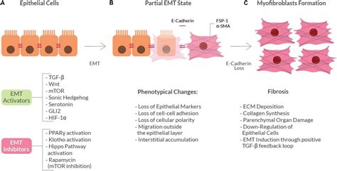 Frontiers | The Epithelial-to-Mesenchymal Transition as a Possible Therapeutic Target in ...