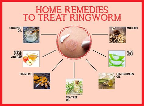 Best Home Remedies For Ringworm | Femina.in