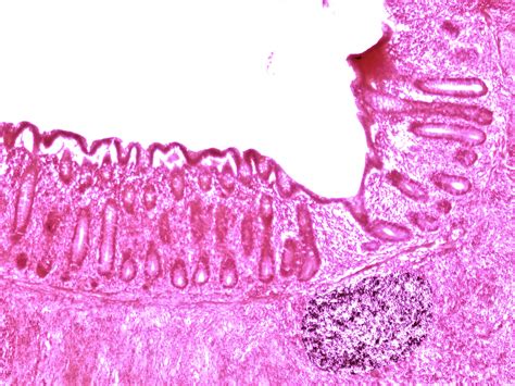 Appendix Histology