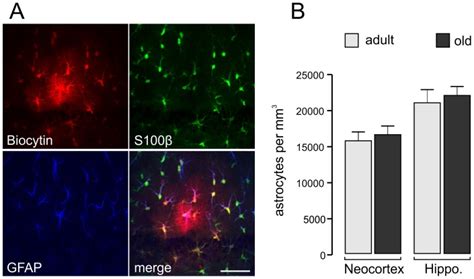 (A) Verification of S100β as suitable astrocyte marker to quantify cell... | Download Scientific ...