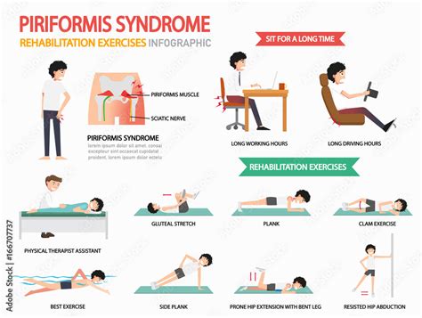 piriformis syndrome rehabilitation exercises infographic, illustration. Stock Vector | Adobe Stock