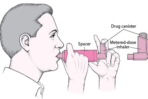 Drugs for Preventing and Treating Asthma - Lung and Airway Disorders - MSD Manual Consumer Version