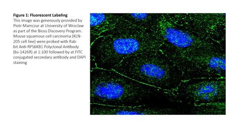 Fluorescent vs. Chromogenic Detection in Immunohistochemistry