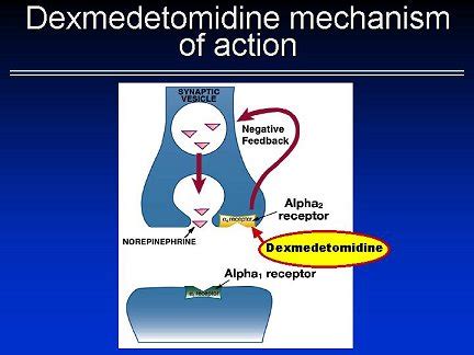 The Dexmedetomidine Source