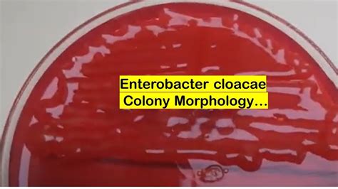 Enterobacter cloacae growth on CLED agar of Urine Culture - YouTube