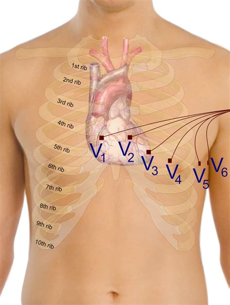 Récap' IDE: L'électrocardiogramme (ECG)