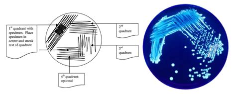 Streak Plate Method: Principle, Procedure, Uses • Microbe Online