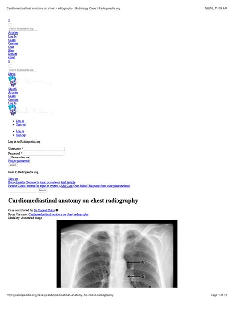 Cardiomediastinal Anatomy On Chest Radiography - Radiology Case | PDF | Radiography | Medical ...