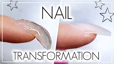 How To Correct A Hooked Nail Using Gel | Nail Transformation! - YouTube