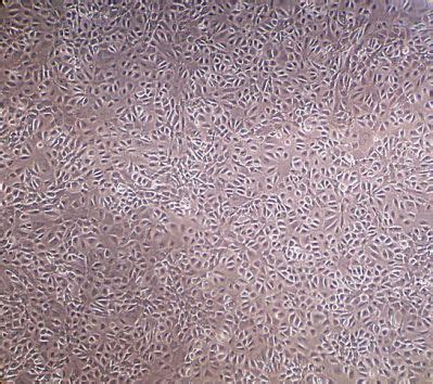 Cells and Fibers - Mesothelial cells - cell culture