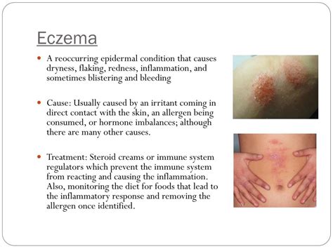 PPT - Pathologies of the Integumentary System PowerPoint Presentation, free download - ID:2680294