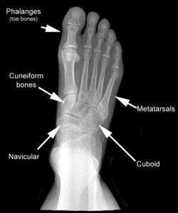 foot-xr-normal-ap-with-text3 – Drwolgin