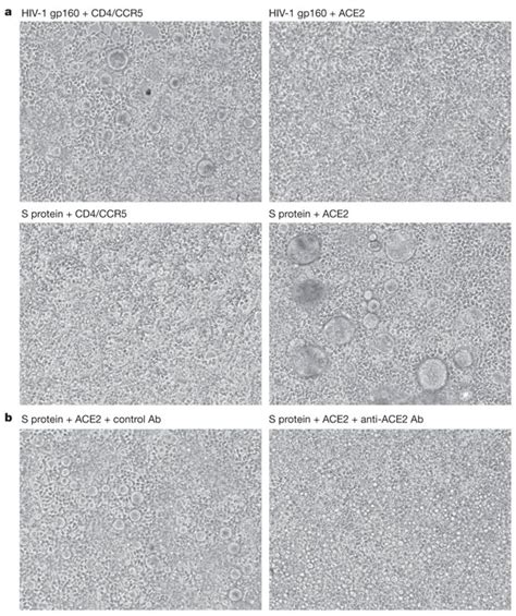 Syncytia formation between S-protein- and ACE2-expressing cells.a, 293T ...