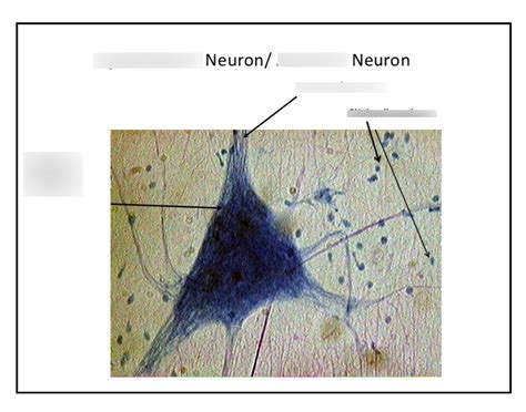 A&P - Spinal Motor Neuron / Anaxonic Neuron Diagram | Quizlet