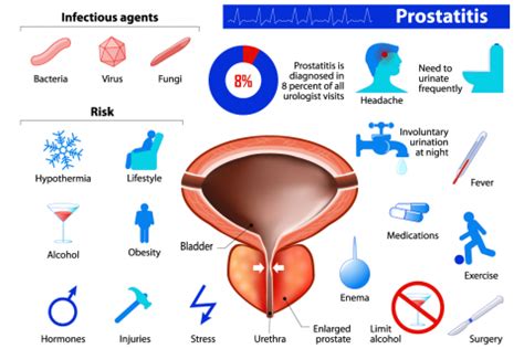 Prostatitis - Prostate Specialist Consultant in Sussex - The Sussex Prostate Centre