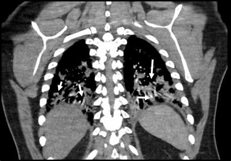 J Med Cases