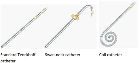 Simplified Medical Placement Of Tenckhoff Catheter Under Local Anesthesia - Naturalmedico