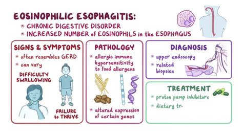 Eosinophilic Esophagitis Symptoms, Causes, Treatment NORD, 56% OFF