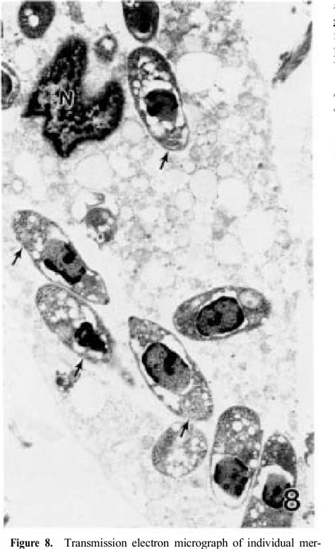 Figure 8 from Immunohistochemical Diagnosis of Protozoan Parasites in Lesions of Equine ...