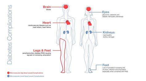 Why Is It Important To Manage My Blood Glucose