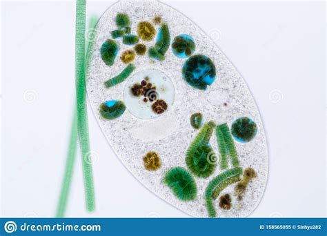 Frontonia Sp. Unicellular Ciliate Protists Under the Microscope. Stock Image - Image of diatoms ...