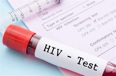 HIV Test – Types, Procedure, Importance and Results - Dr Lal PathLabs Blog