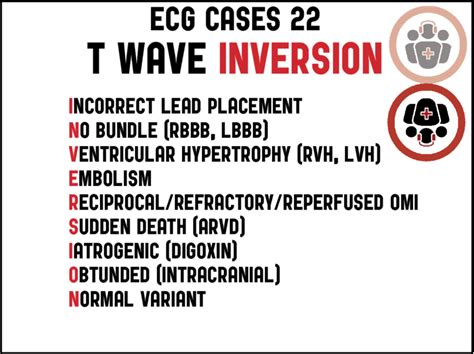 T-wave INVERSION mnemonic | ECG Cases | Emergency Medicine Cases