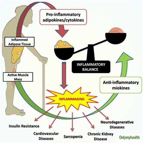 What Is Inflammaging? Know Risk Factors, Complications and Prevention ...