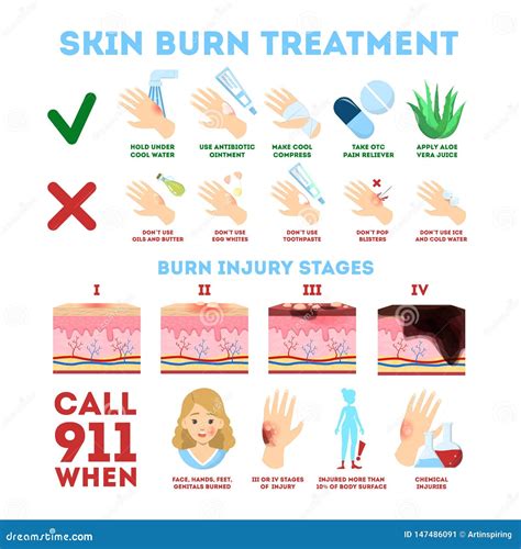 Skin Burn Injury Treatment. First Aid For Burn Wound Vector ...