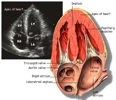 Trans-thoracic Echocardiogram (TTE)