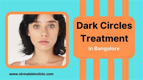 How To Get Rid of Under Eyes Dark Circles? - Top Blogger Chronicles: Unveiling the Best of the ...