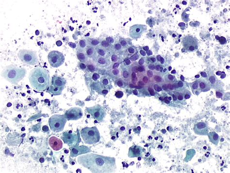 Cytopathology of the uterine cervix - digital atlas