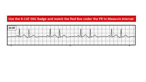 EKG Concepts - Case Study Chronicles 7