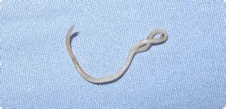 Roundworms are a Common Intestinal Parasite in Cats and Kittens