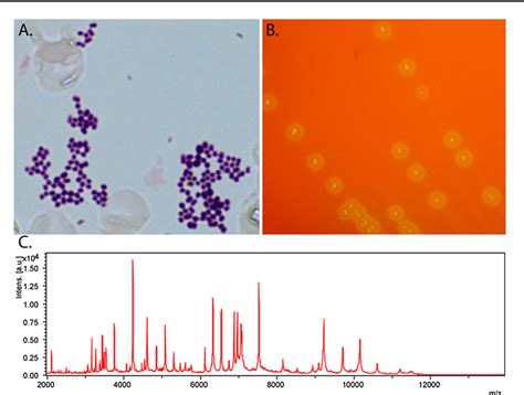 Aerococcus sanguinicola | Semantic Scholar