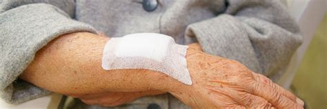 Elderly Skin Bruising: Causes and Prevention