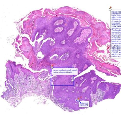 Best cytology slides 🥇 | Posot Class