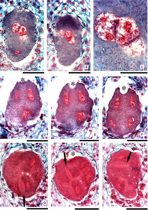 Endosperm formation: subsequent karyokinesis and cytokinesis stages ...