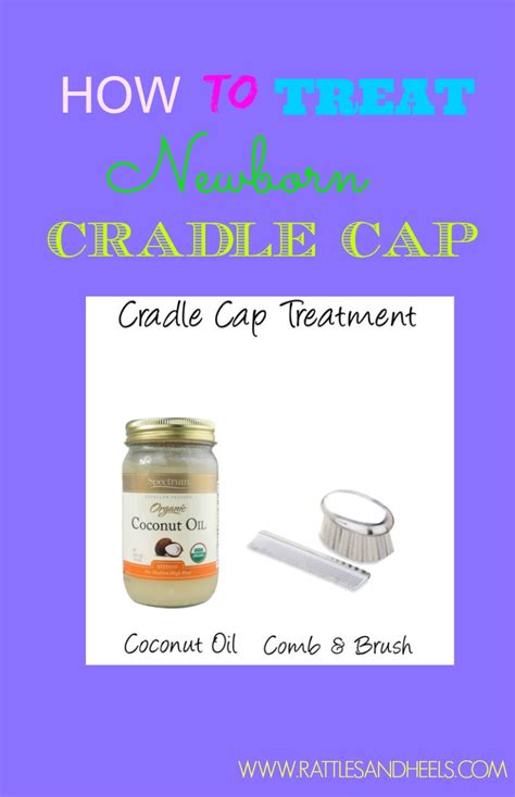 How To Use Coconut Oil To Treat Cradle Cap - Rattles & HeelsRattles & Heels