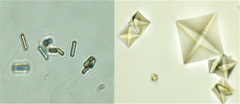 Different morphologies of crystals made of calcium oxalate dihydrate ...