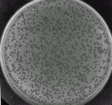 Bacteriophage Plaque Assay: Principle, Procedure and Results - Learn Microbiology Online