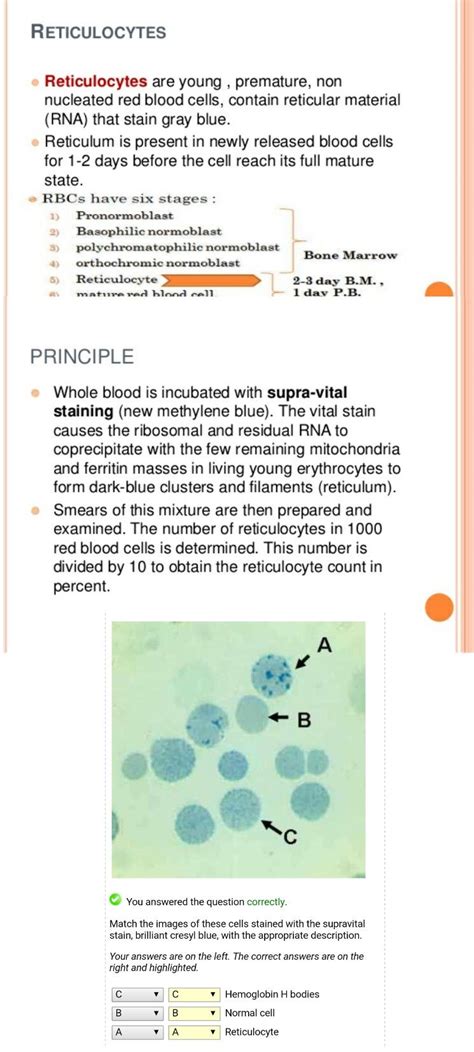 Reticulocyte and Supravital staining for it ... #Methylene blue | Medical laboratory, Hematology ...