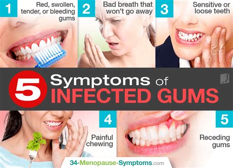 5 Symptoms of Infected Gums