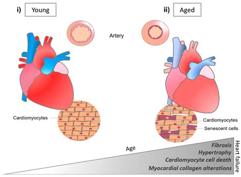 Micromachines | Free Full-Text | Recapitulating Cardiac Structure and Function In Vitro from ...