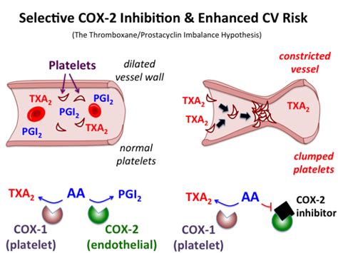 nsaid_side_effects [TUSOM | Pharmwiki]