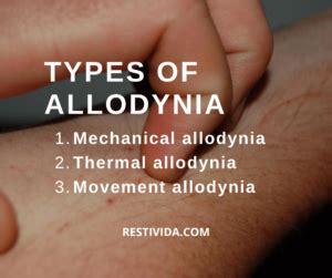 Allodynia: Fibromyalgia Rash