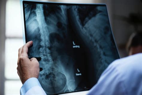 Symptoms of Asbestosis - Recognising the Signs | About the House